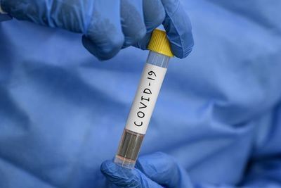 Avanza la investigación para hallar un tratamiento contra la COVID-19 - Ciencia - ABC Color