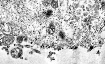 HOY / Captan imágenes de momento exacto en que coronavirus infecta una célula