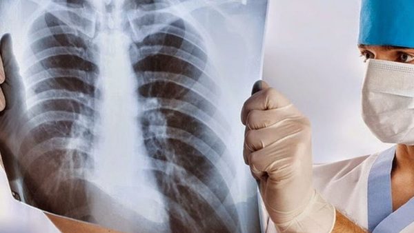 Salud gasta G. 5.240 millones en rayos X