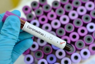 COVID-19: Paraguay registra 124 casos de pacientes con coronavirus