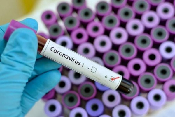 COVID-19: Paraguay registra 124 casos de pacientes con coronavirus