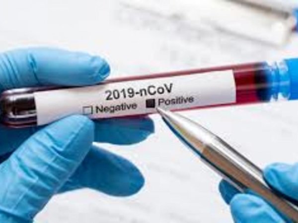 Confirman el primer caso de coronavirus en Canindeyú