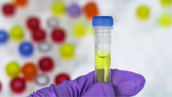 Biotec acumula G. 23.000 millones en emisión de bonos y proveerá al mercado interno 40.000 test para COVID-19