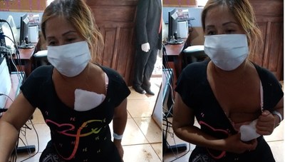 Humillan en controles de cumplimientos de cuarentena: la denuncia de una mujer que mostró su seno operado y no sensibilizó a fiscales - ADN Paraguayo