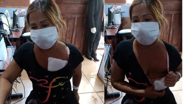 Humillan en controles de cumplimientos de cuarentena: la denuncia de una mujer que mostró su seno operado y no sensibilizó a fiscales - ADN Paraguayo
