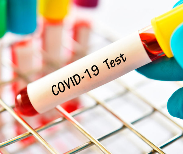 Casos de coronavirus superan los 200 este viernes