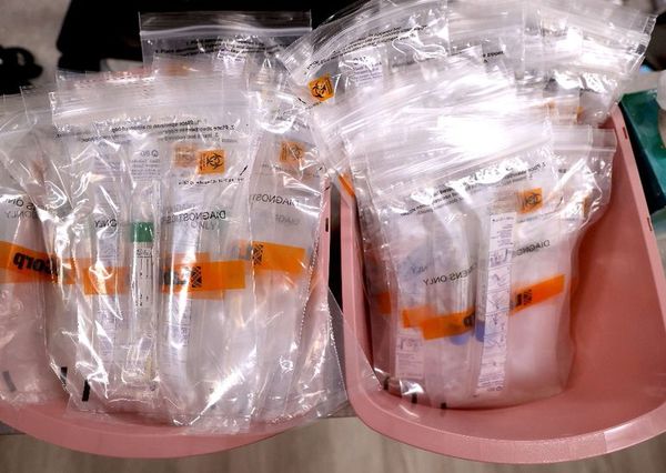 “Tenemos capacidad de procesar 500 muestras por día”, afirma Portillo - Nacionales - ABC Color