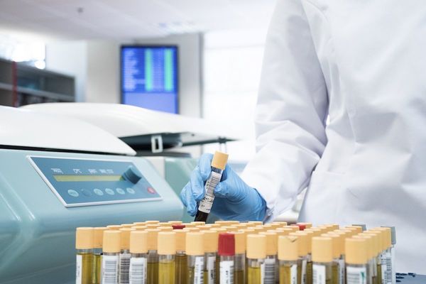 Tratamiento contra malaria está asociado a más muertes por COVID-19, según estudio