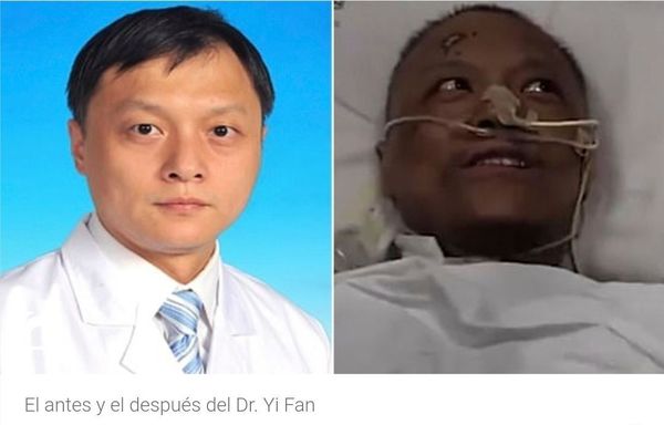El extraño cambio en el color de la piel de dos médicos que sobrevivieron al coronavirus en Wuhan - Digital Misiones