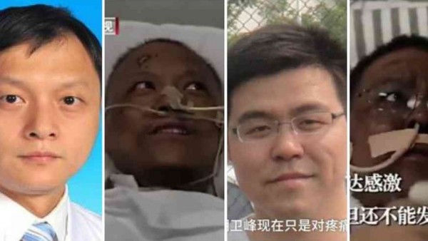 Extraño cambio de Color en la Piel de dos Médicos que tuvieron Coronavirus en Wuhan | Info Caacupe