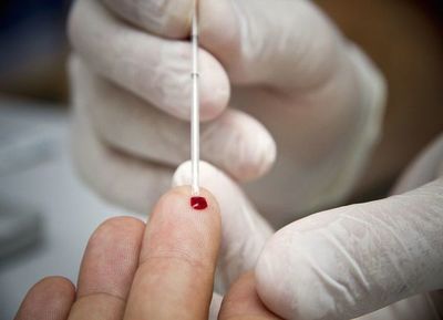 Realizan test de VIH, sífilis y hepatitis B, con agendamiento previo