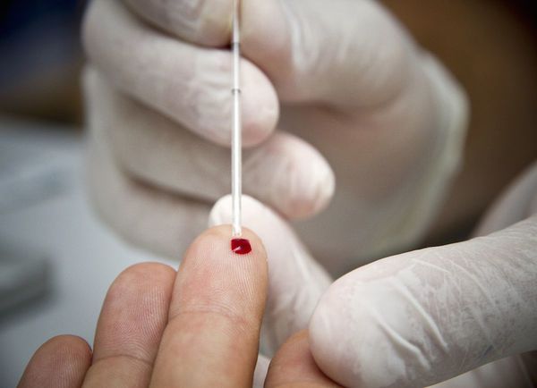 Realizan test de VIH, sífilis y hepatitis B, con agendamiento previo