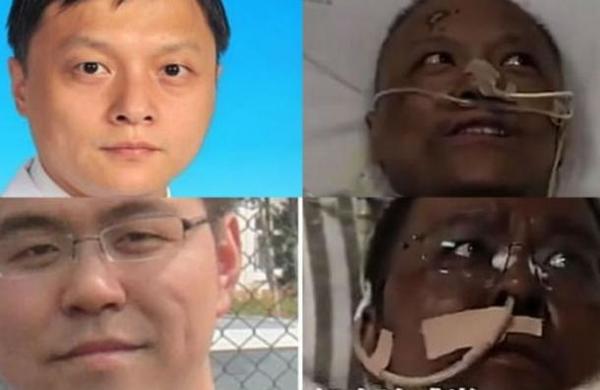 Difunden imágenes de dos médicos chinos a los que el Covid-19 les oscureció la piel - SNT