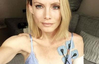 Doble de Milla Jovovich gana demanda por terrible accidente grabando 'Resident Evil': perdió un brazo - SNT