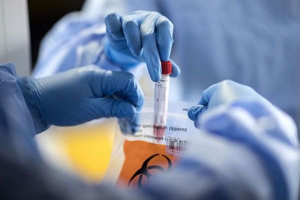 OMS: No hay pruebas de que personas infectadas con COVID-19 estén inmunizadas