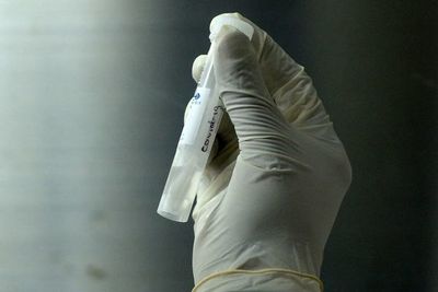 Crece el debate por el “pasaporte de inmunidad” al coronavirus - Ciencia - ABC Color