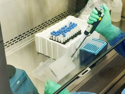 Covid-19: Organismo internacional donará tests rápidos a Paraguay