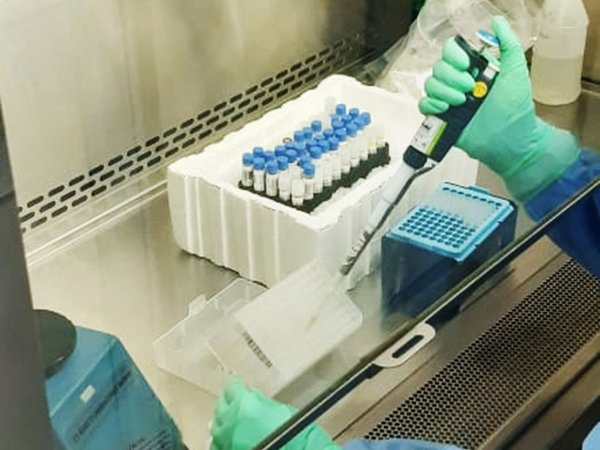 Covid-19: Organismo internacional donará tests rápidos a Paraguay