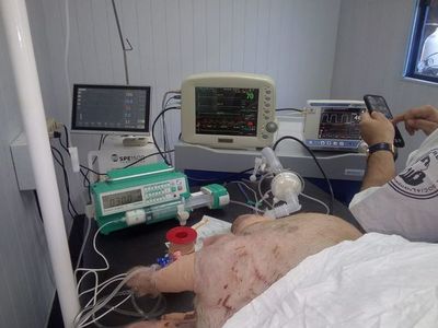Prueban respirador diseñado por paraguayos - Nacionales - ABC Color