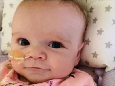 Bebé de 6 meses fue operada del corazón y se recuperó del Covid-19