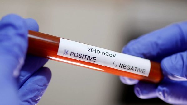 China amenaza a Australia con bloquear el consumo de sus productos si insiste en investigar el origen del Coronavirus