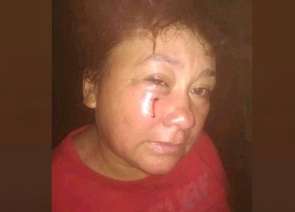 Quería ligar algo de morfi, pero terminó ligando palo | Crónica