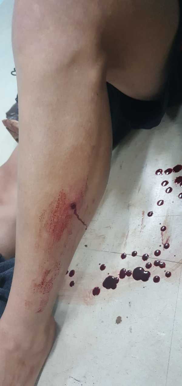 Dos motochorros baleados tras intento de asalto y persecución