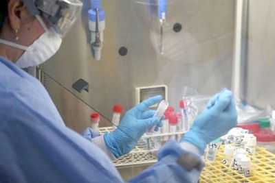 Agregan síntomas a la hora de pillar al virus | Crónica