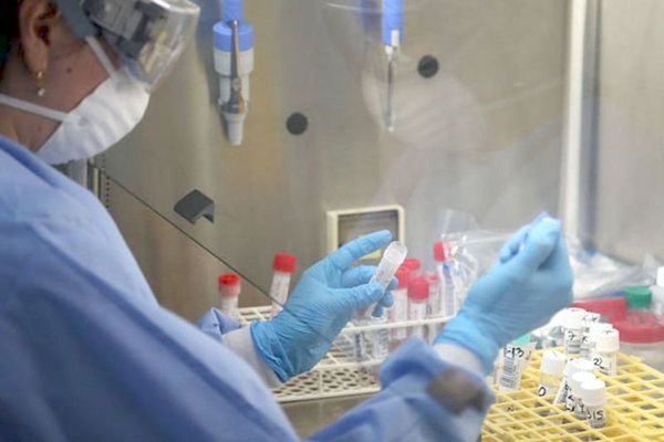 Agregan síntomas a la hora de pillar al virus | Crónica