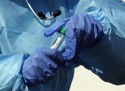 Coronavirus: Ante posible proliferación, instan a tener cuidado con los tests rápidos » Ñanduti