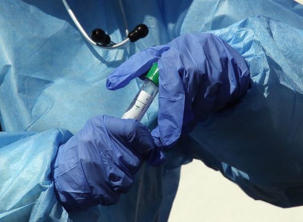 Coronavirus: Ante posible proliferación, instan a tener cuidado con los tests rápidos » Ñanduti