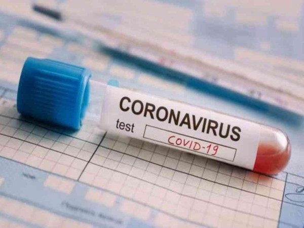 COVID-19: Descartan reinfecciones en pacientes recuperados
