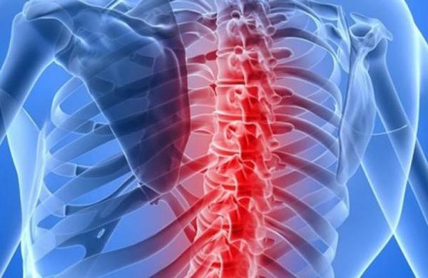 El Ministerio de Salud cubrirá el tratamiento de pacientes con atrofia muscular espinal - C9N