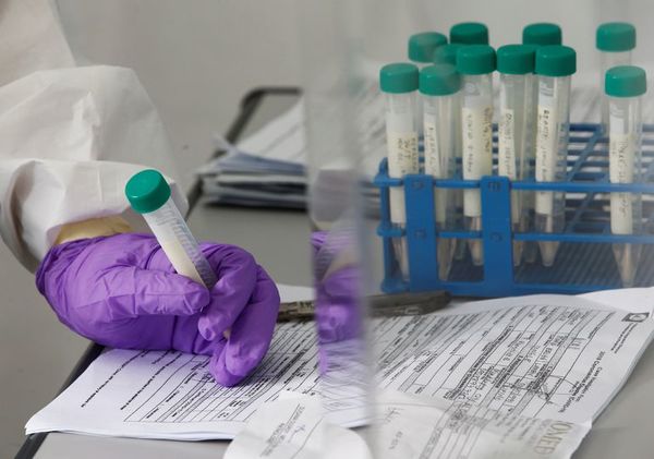 COVID-19: Paraguay participará en ensayo clínico global - Nacionales - ABC Color