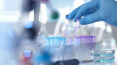 Instituto biológico de Israel desarrolló anticuerpos contra el COVID-19