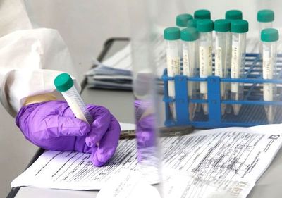 Ensayo: 400 paraguayos probarán tratamientos de OMS