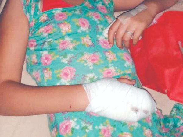 Pitbull casi le arrancó la mano a una niña de 12 años