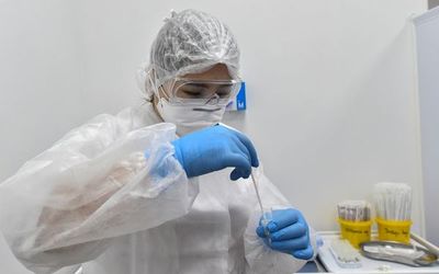 OMS: Un test positivo tras curación de COVID-19 no forma parte de una reinfección - Mundo - ABC Color