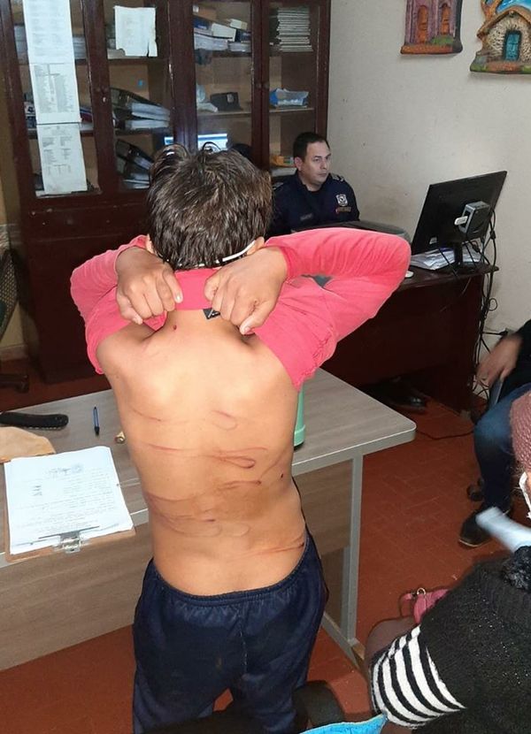 Menor de 13 años fue golpeado salvajemente por su hermano de 21