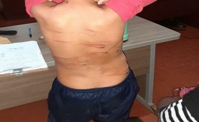 Denuncian a un hombre por golpear salvajemente a su hermano de 13 años