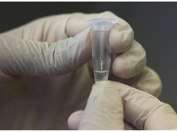 Un estudio detecta coronavirus en el semen de pacientes