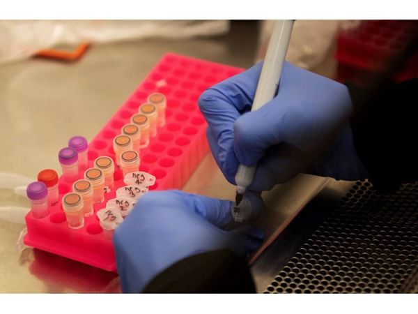 No hallan ventajas ni daños en uso de hidroxicloroquina