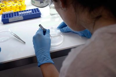 CIENTÍFICOS ARGENTINOS DESARROLLAN KITS QUE DETECTAN CORONAVIRUS EN UNA HORA