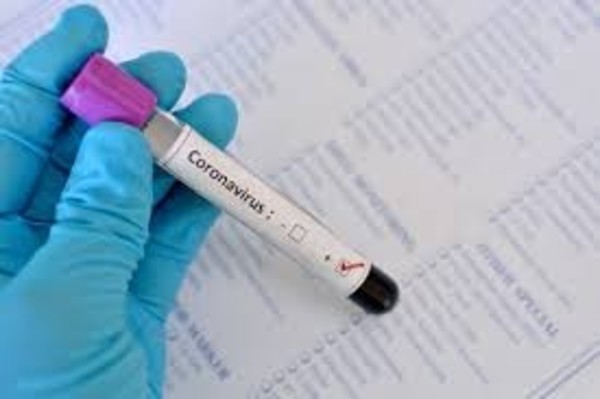 COVID-19: Más de 332.000 casos confirmados y los fallecidos superan los 14.500