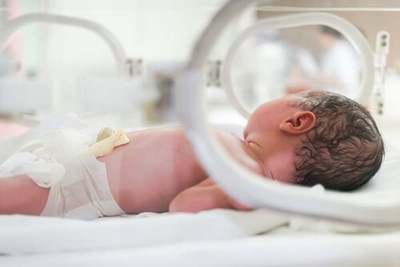 DOS BEBÉS PREMATUROS MUEREN EN PJC POR FALTA DE TERAPIA NEONATAL