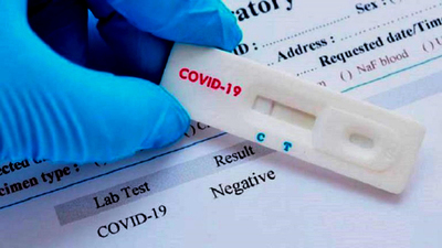 ACCESO A RESULTADOS DE TEST DE COVID 19 SERÁN DIGITALES.