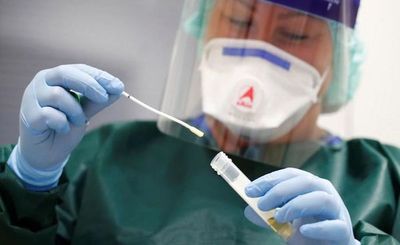 Abrirán más laboratorios y números de pruebas crecerán
