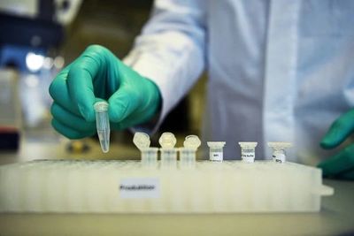 Salud habilitará laboratorios para superar las 1.000 pruebas diarias de Covid-19 - Paraguay Informa