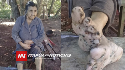 VECINOS PIDEN AYUDA PARA MUJER EN SITUACIÓN DE ABANDONO EN TRES POTRERO ENCARNACIÓN.