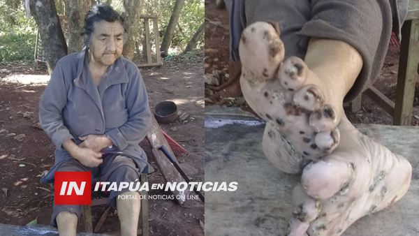 VECINOS PIDEN AYUDA PARA MUJER EN SITUACIÓN DE ABANDONO EN TRES POTRERO ENCARNACIÓN.